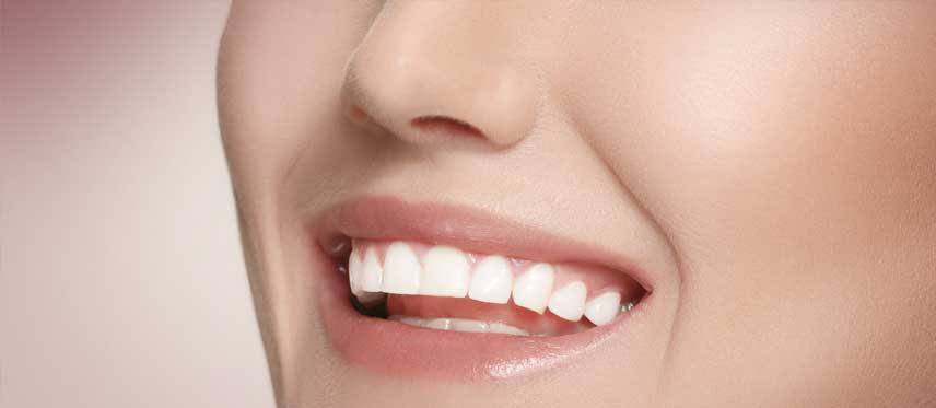 Diseño de sonrisa perfecta