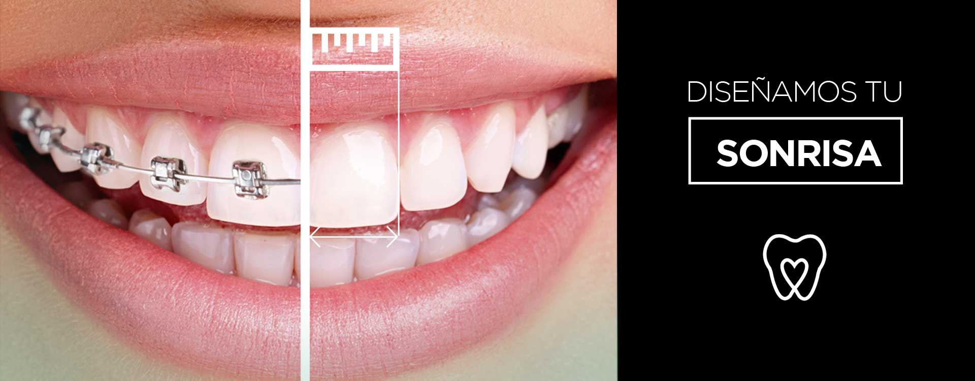 Grafico diseño de sonrisa